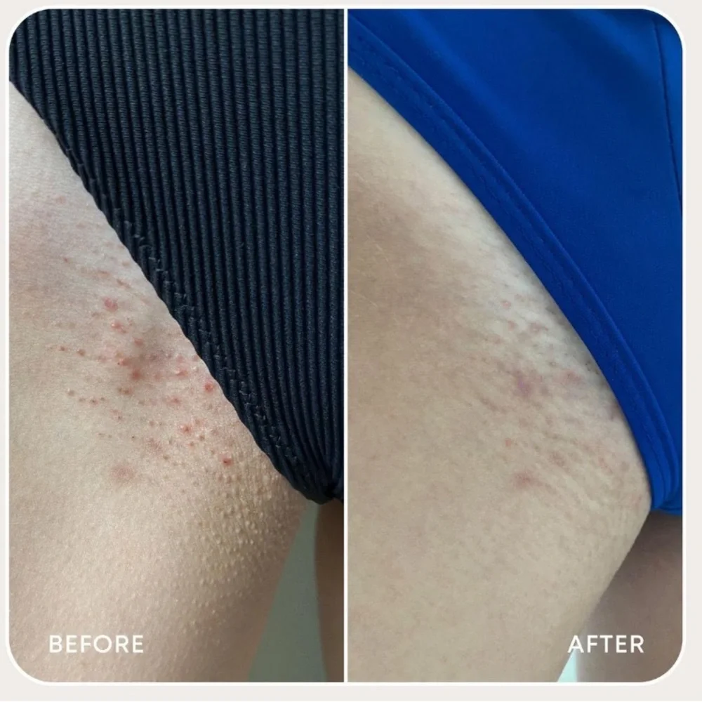 Bush Balm Nude Ingrown Hair Oil - Blue